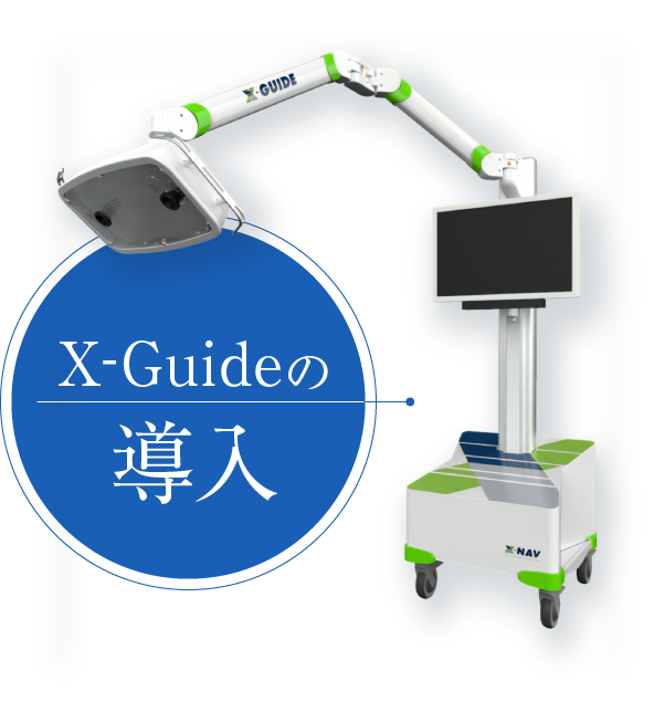 X-Guideの導入