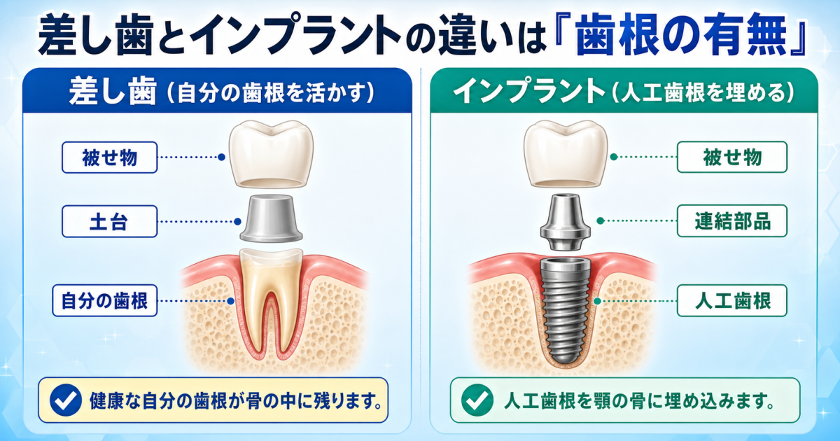 ■差し歯とインプラントの違いは「歯根があるかないか」で決まる