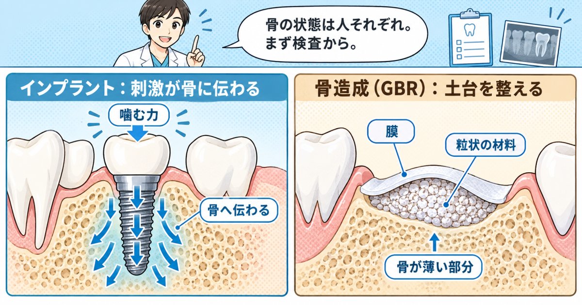 骨吸収の進行を食い止めて口元のハリを守る治療の選択肢