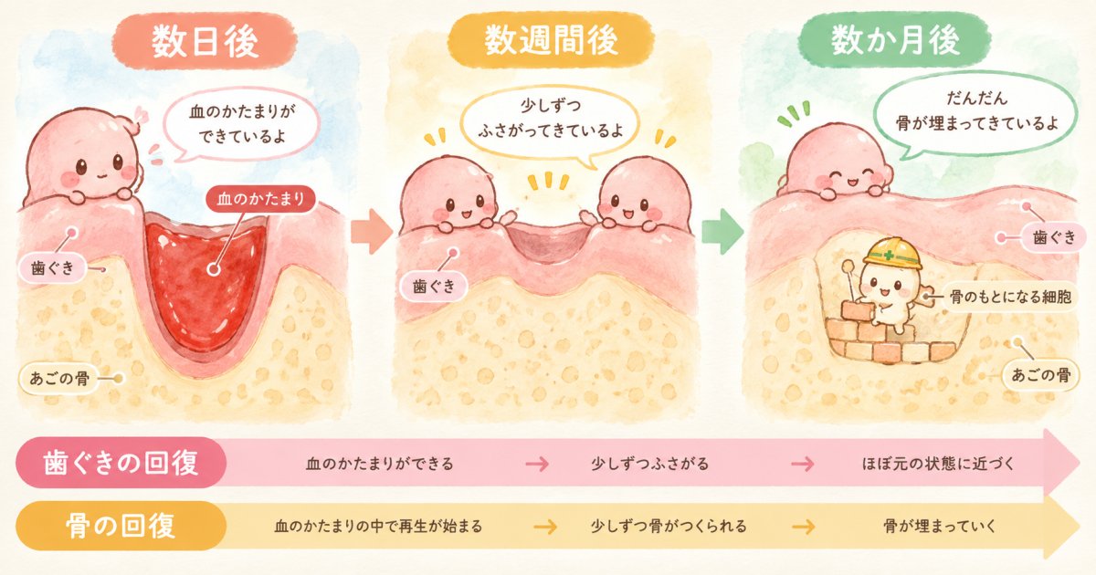歯ぐきがふさがるまでと、骨が回復するまでの経過