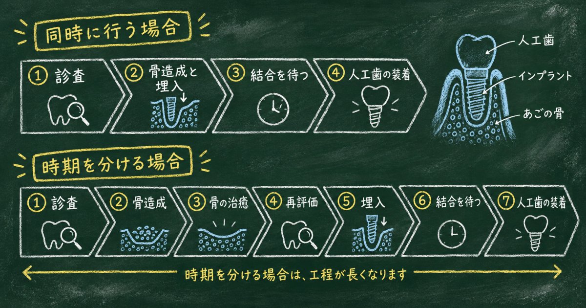 骨造成をすると治療期間はどのくらい変わる？