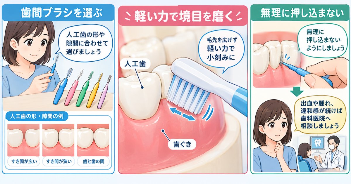 人工歯根の毎日のケア｜歯ぐきを守る磨き方と歯間ブラシの選び方